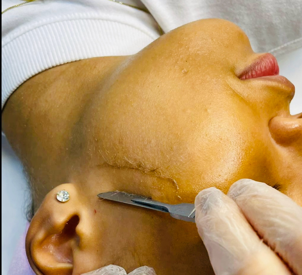 DEWrmaplaning glow at Dewy Glow Skin Studio in Granda Hills, CA