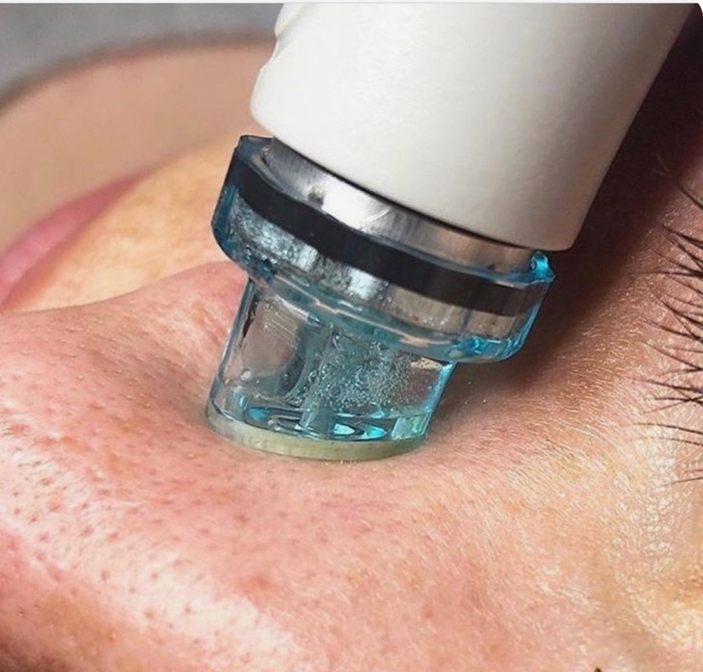 ADD ON- HYDRO Dermabrasion