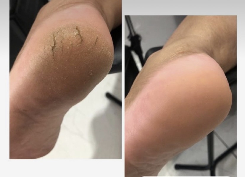 Medi-Pedi Level 1