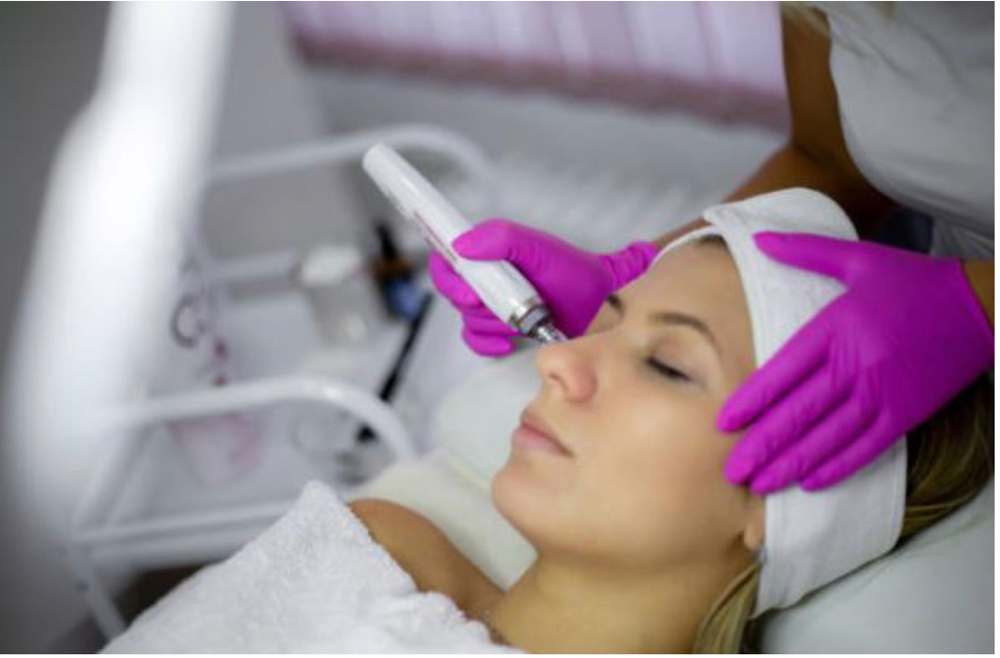 Microneedeling at Spa2you in Tucson, AZ