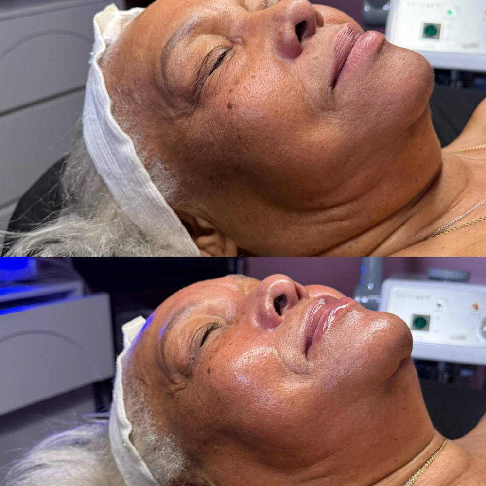 Microcurrent Add on at Lanai Beauty Bar in Concord, CA