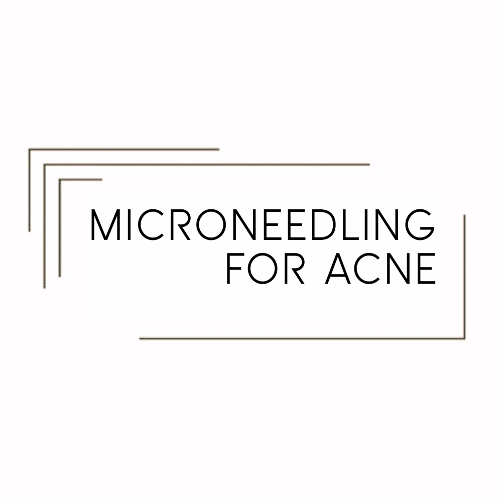 MICRONEEDLING | ACNE