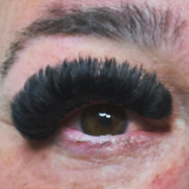 Mega Fill at Erika Violette in Las Vegas, NV