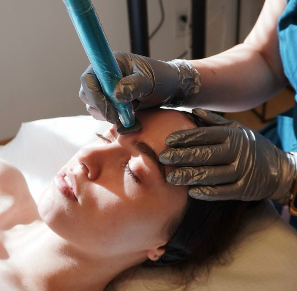 MICROCHANNELING at HOUSE OF SKIN BY MIRIAM in Palm Desert, CA