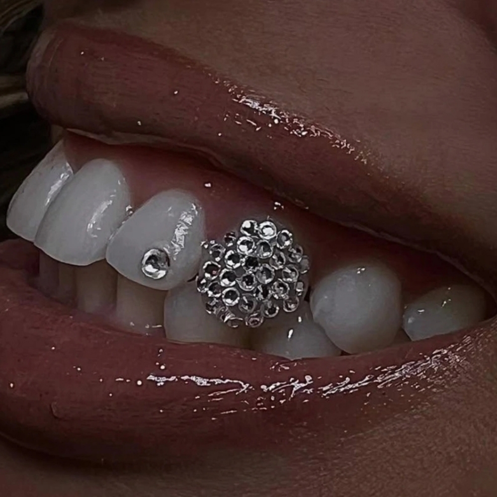Tooth Gem- Disco Ball Design at Teeth Whitening Lounge in Santa Ana, CA