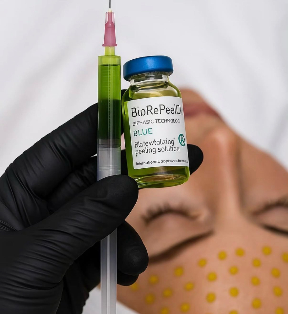 BioRePeel at Triple B in La Porte, TX