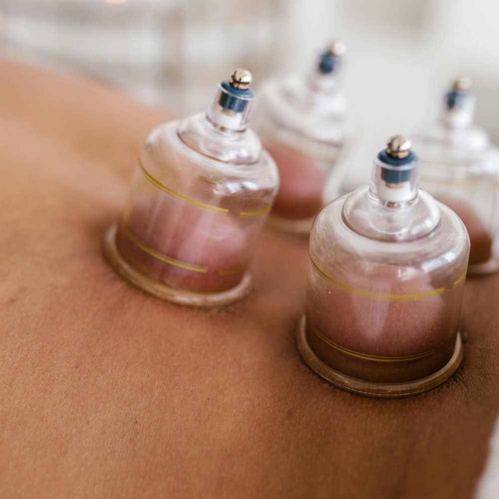 Integrative Massage with Cupping at Body Works Massage + Wellness in Burlington, NC