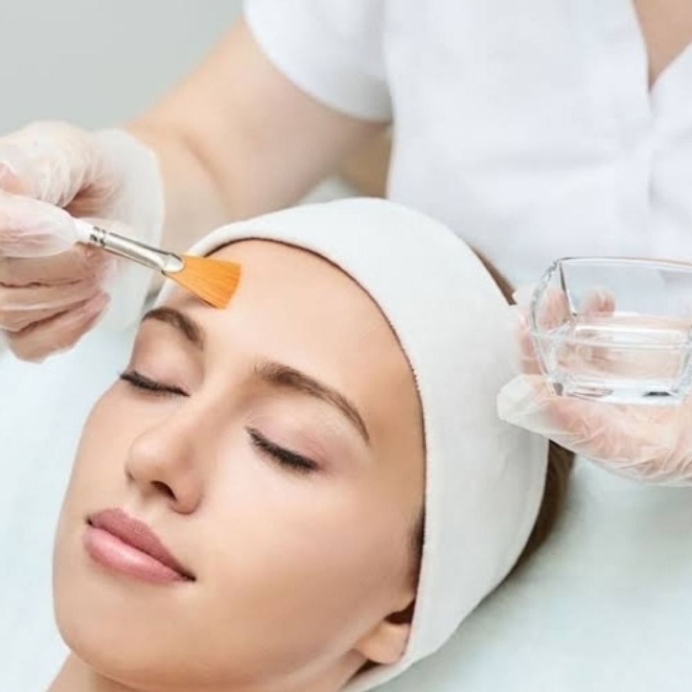 PCA SKIN RESURFACING PEEL at Luna Lash Artistry in Newton Highlands, MA