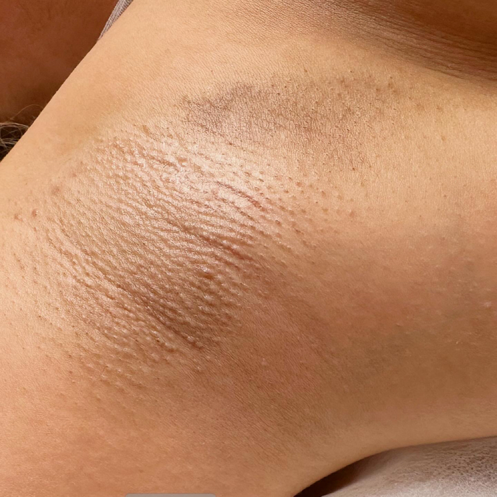 Underarm at Polished Peach Wax Studio in Phoenix, AZ