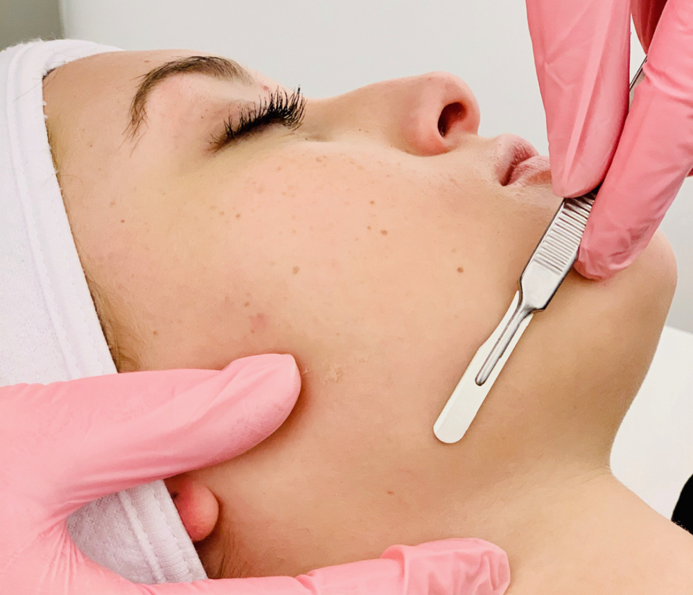 Dermaplane