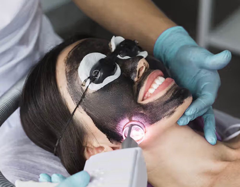 Carbon Facial at Luvlookbeautyspa @GlossGenius in Las Vegas, NV