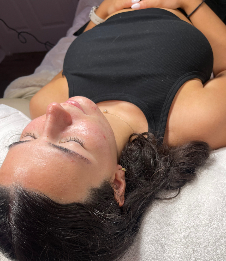 Advanced Resurfacing Facial