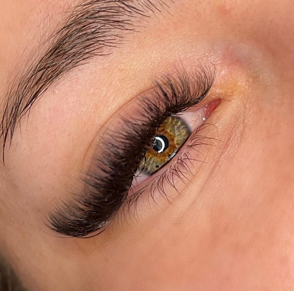 Volume Fill 2-3 Weeks at Alexandra Aesthetics in Punta Gorda, FL