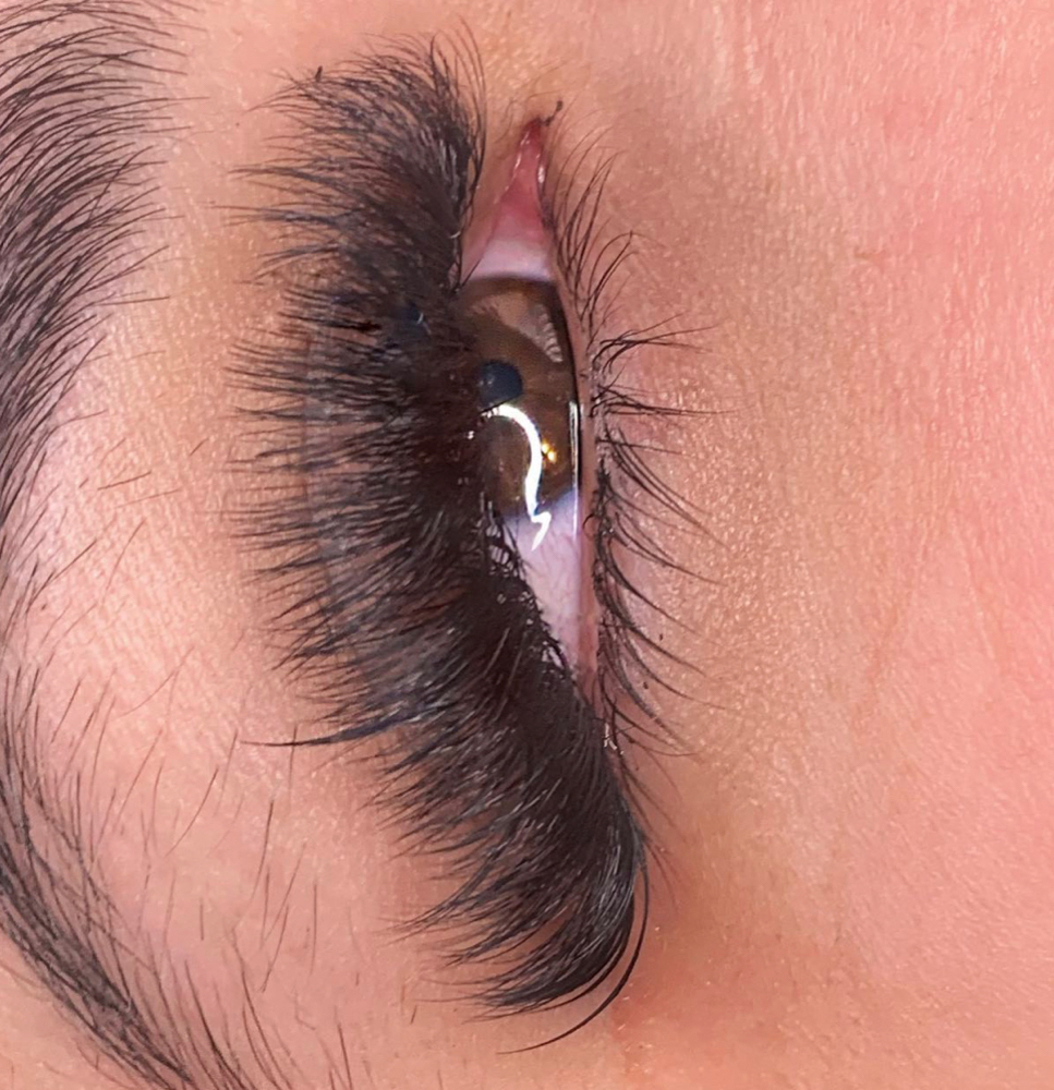 Megavolume Fill 2-3 Weeks at Alexandra Aesthetics in Punta Gorda, FL