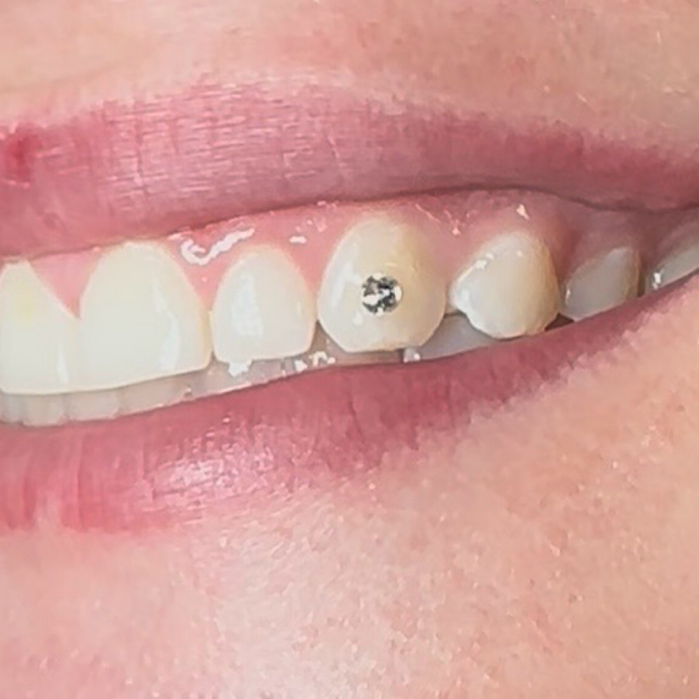 1 Tooth Gem at Sacred Gemz by T in Lindale, TX
