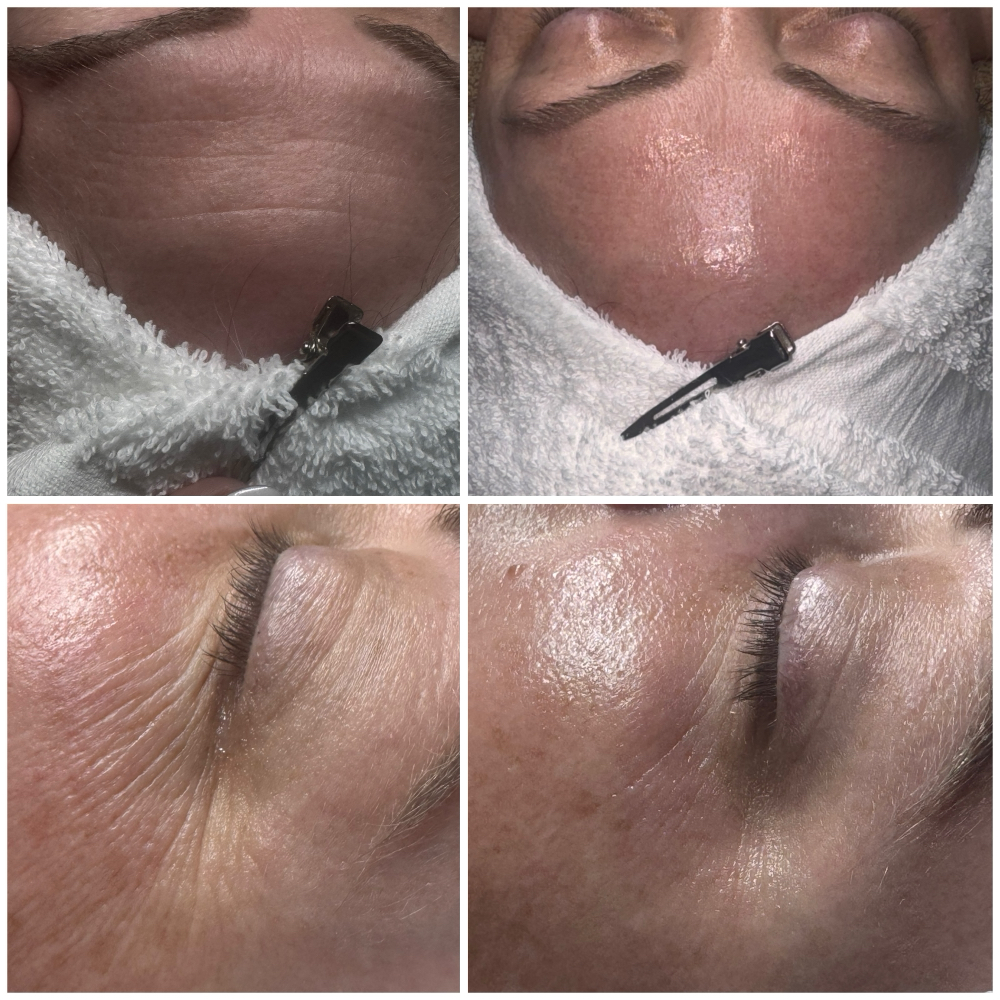 The Luxury Glow Facial