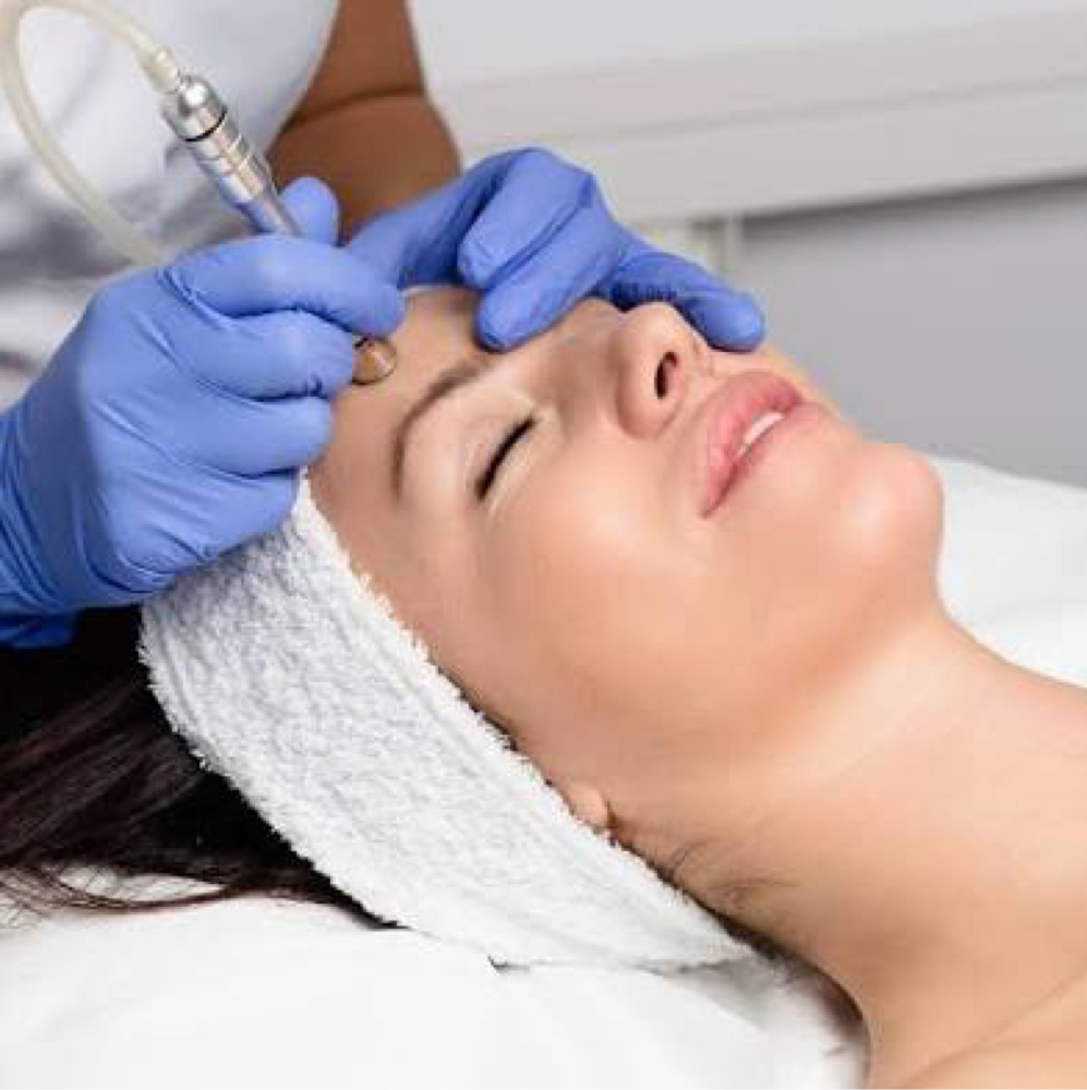 Microdermabrasion Facial at Steven Michael’s Salon in Columbia, SC