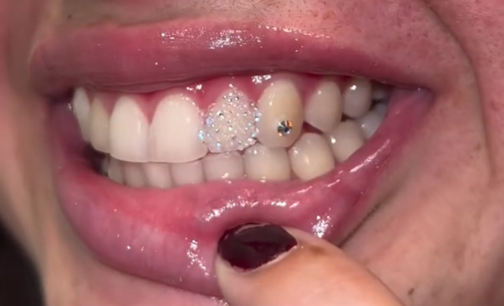 Chandelier Tooth Gems