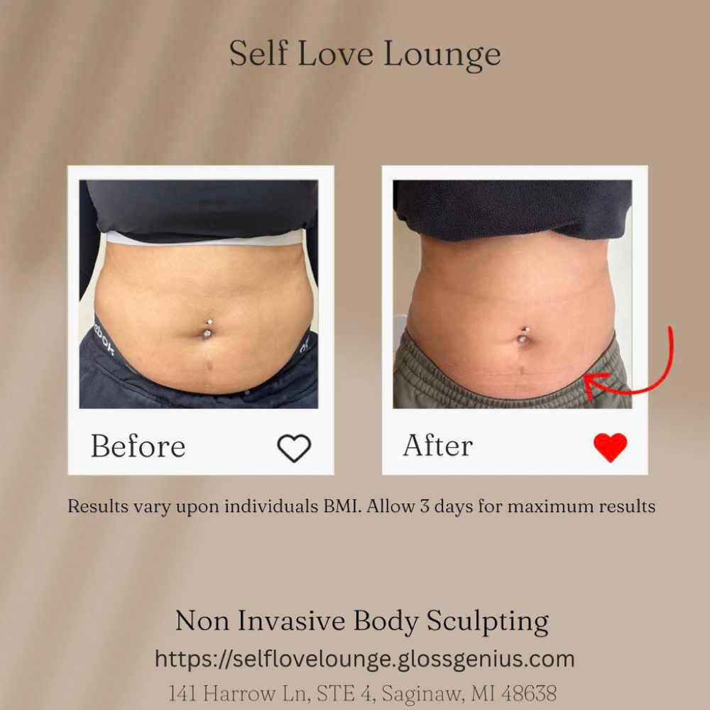 Lipo Cavitation at Self Love Lounge in Saginaw, MI