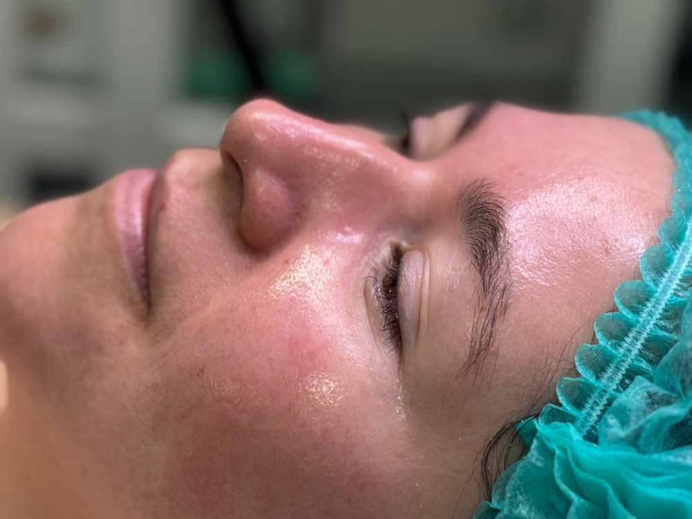 hydrafacial deluxe