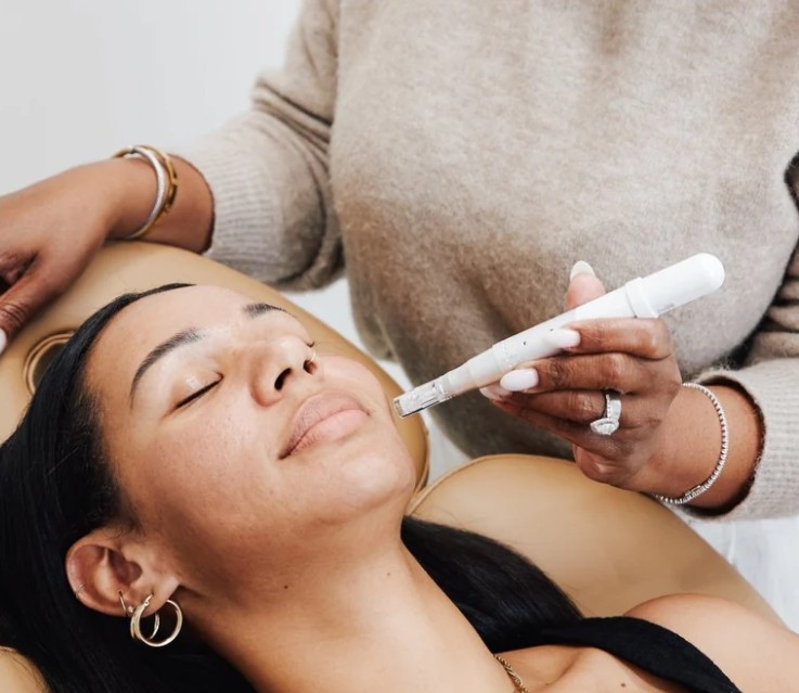 Nano Needling Facial