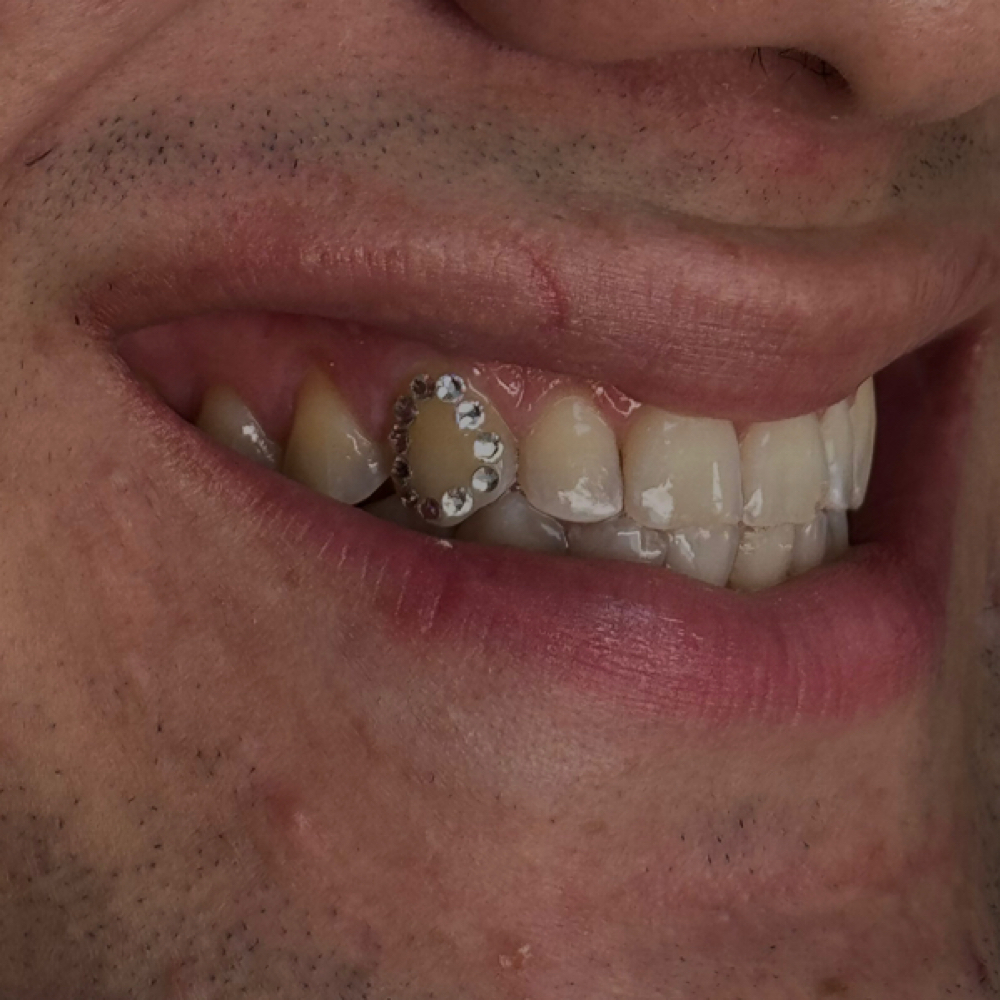 Window Tooth Gems at Jojobeautyyco in Chandler, AZ
