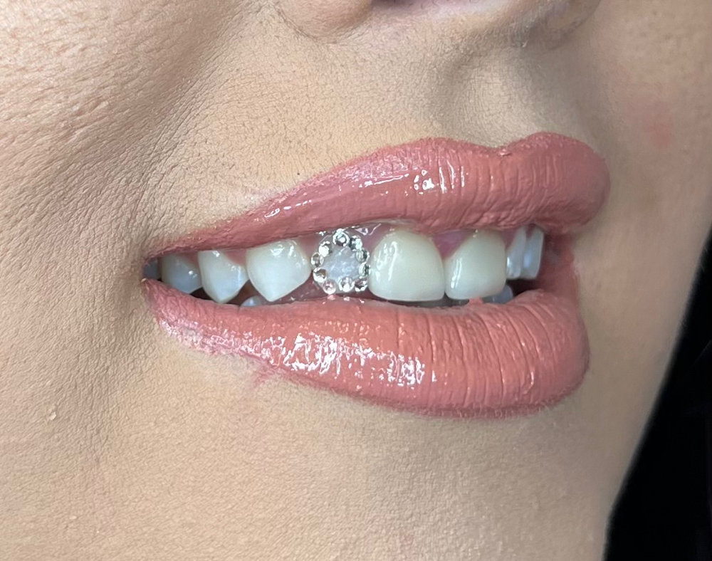 Window Tooth Gems