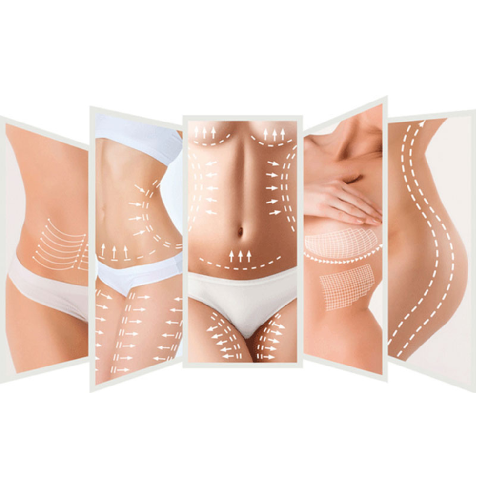 Body Contouring