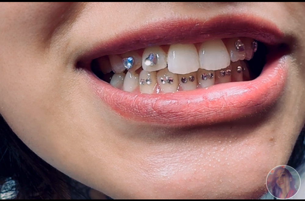 Tooth Gems