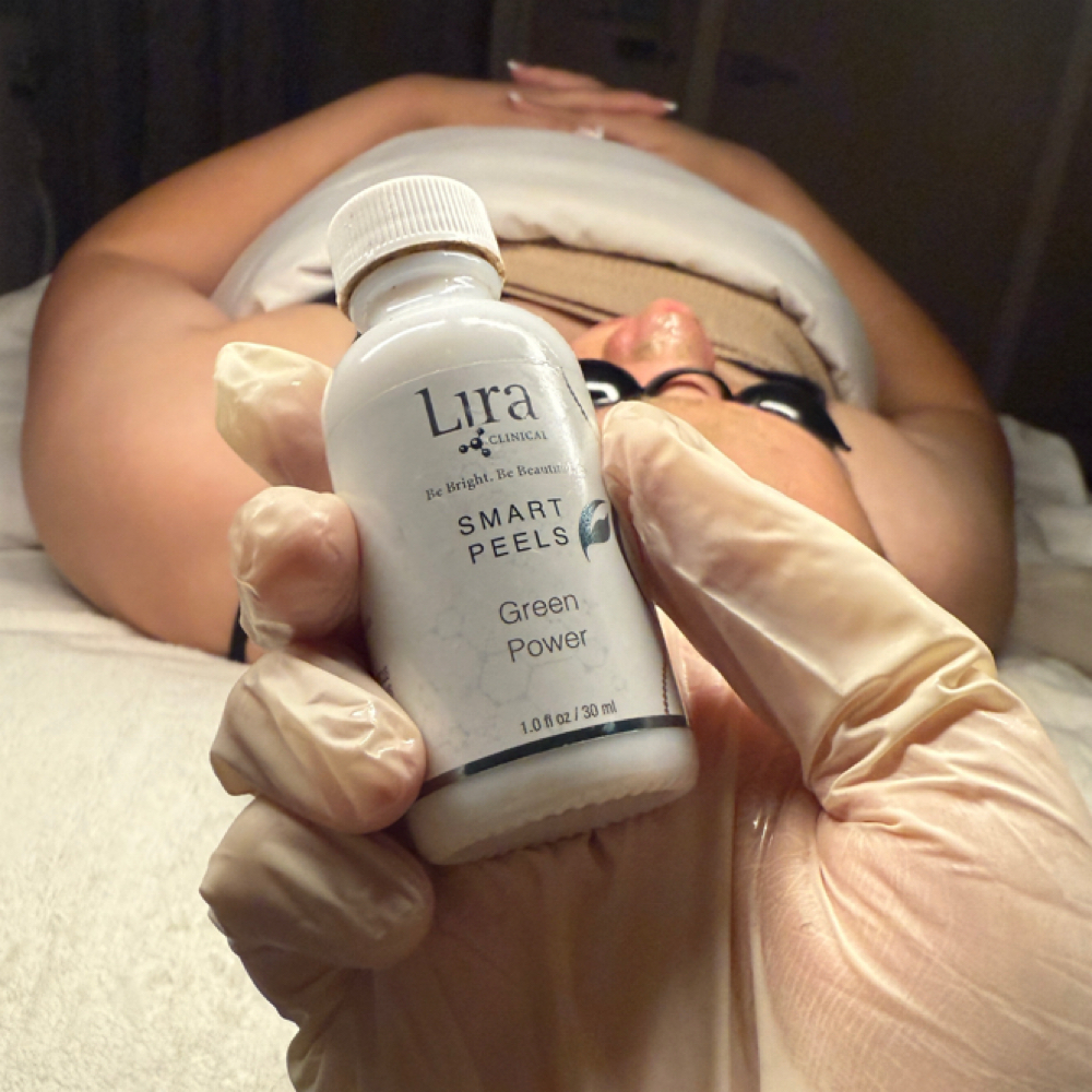 Custom Peel at MySkin Aesthetics in Laredo, TX