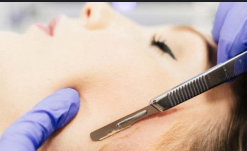 Dermaplaning at Molly Jahromi in Blue Ridge, GA