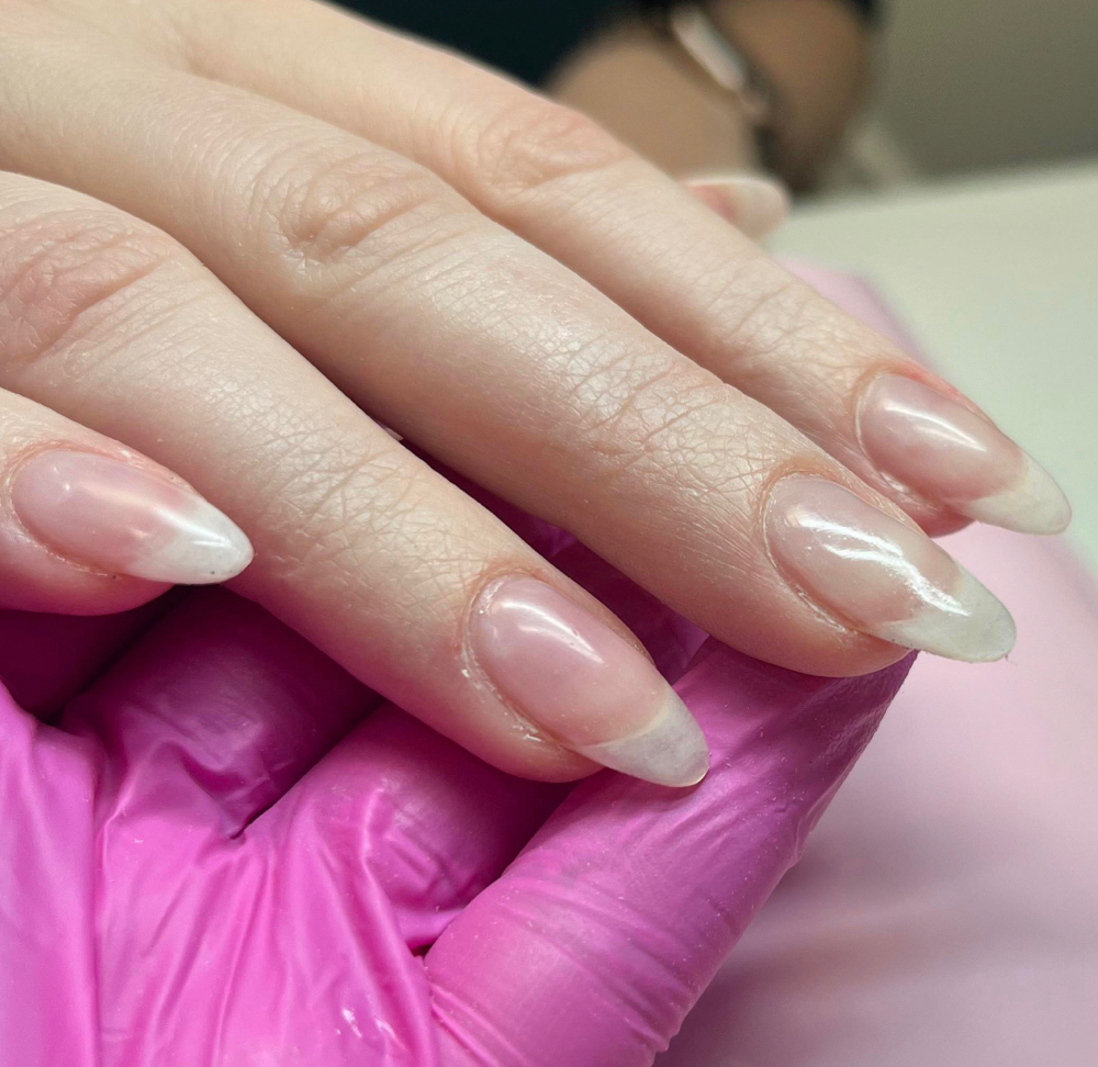 STRUCTURED GEL OVERLAY