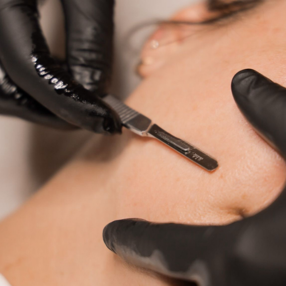 Dermaplane (FACIAL ADD ON) at Enhanced Esthetics in Chowchilla, CA