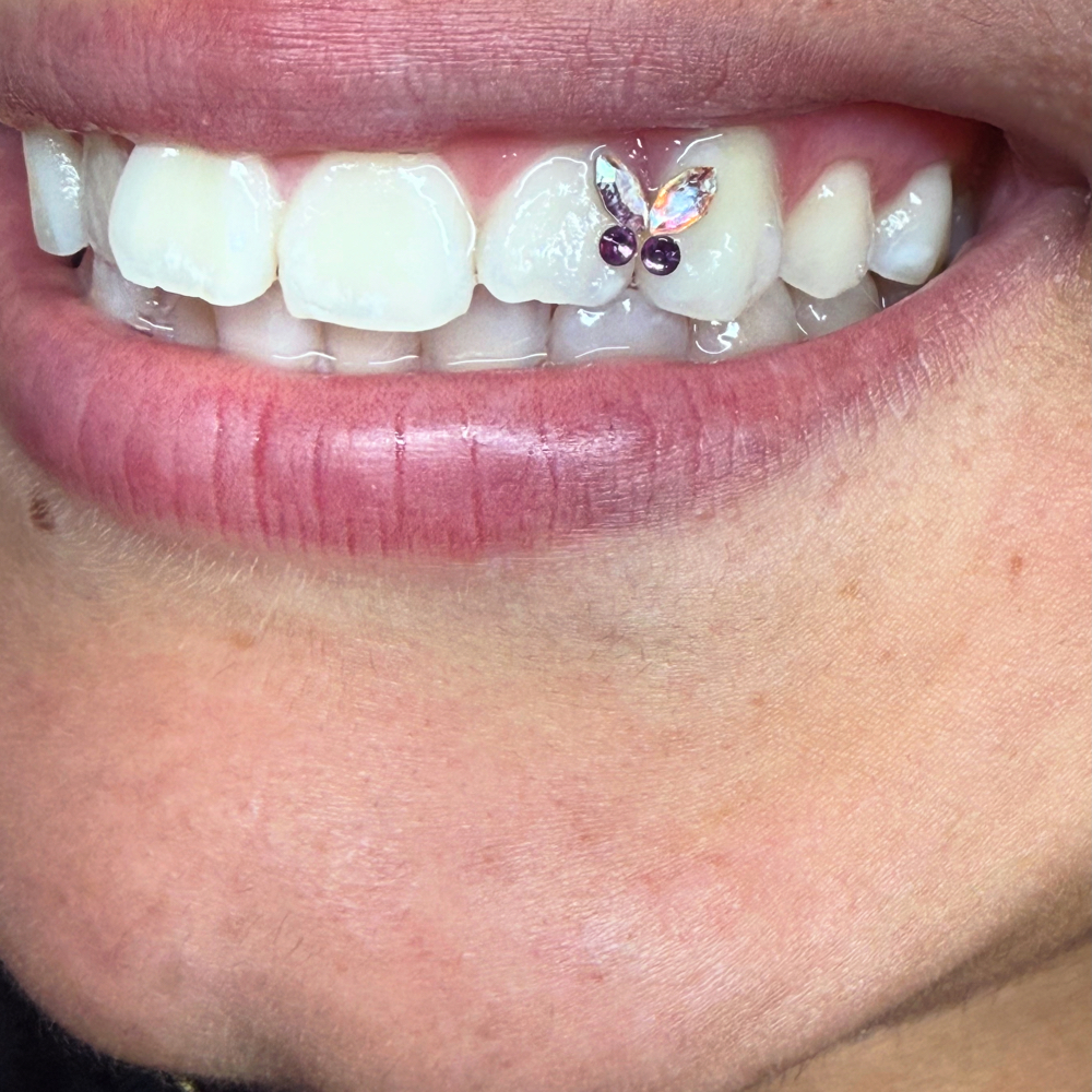 Tooth Gems at Mi Vida Beauty in Tucson, AZ