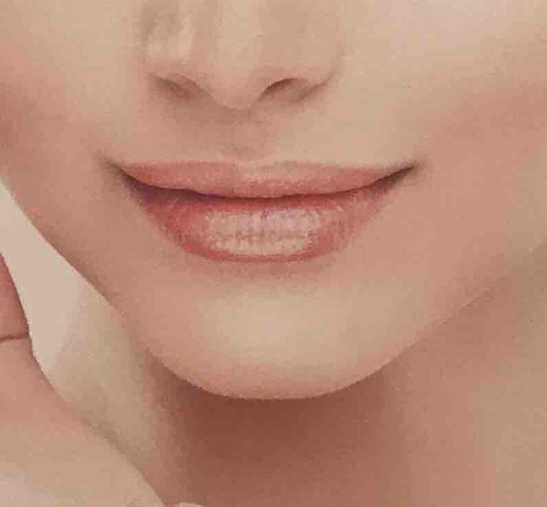 Cryoskin 3.0 Double Chin Reducer