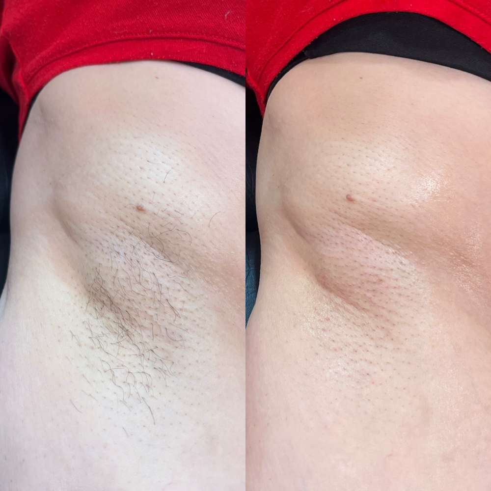 Underarm Wax