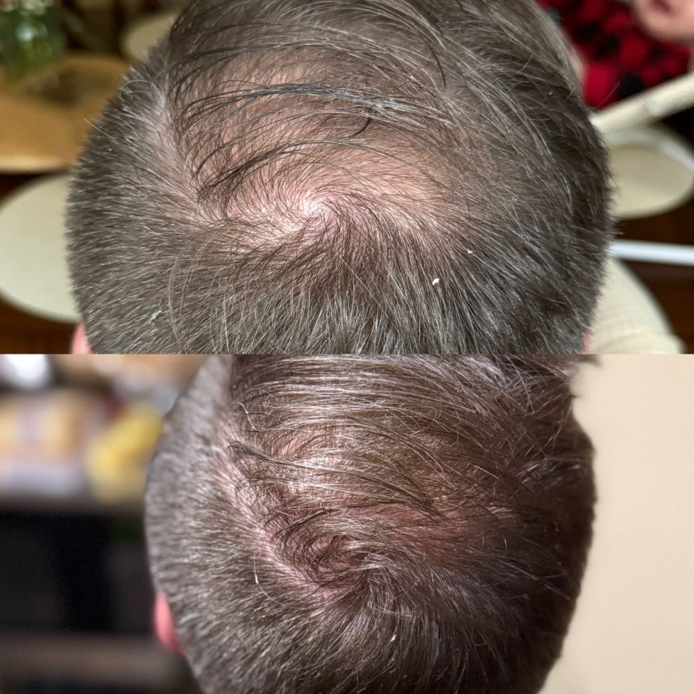 Aurora Density Enhancement