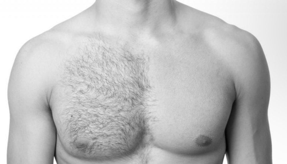 Chest Waxing at Glow Crazy Esthetics in Saint Joseph, MO