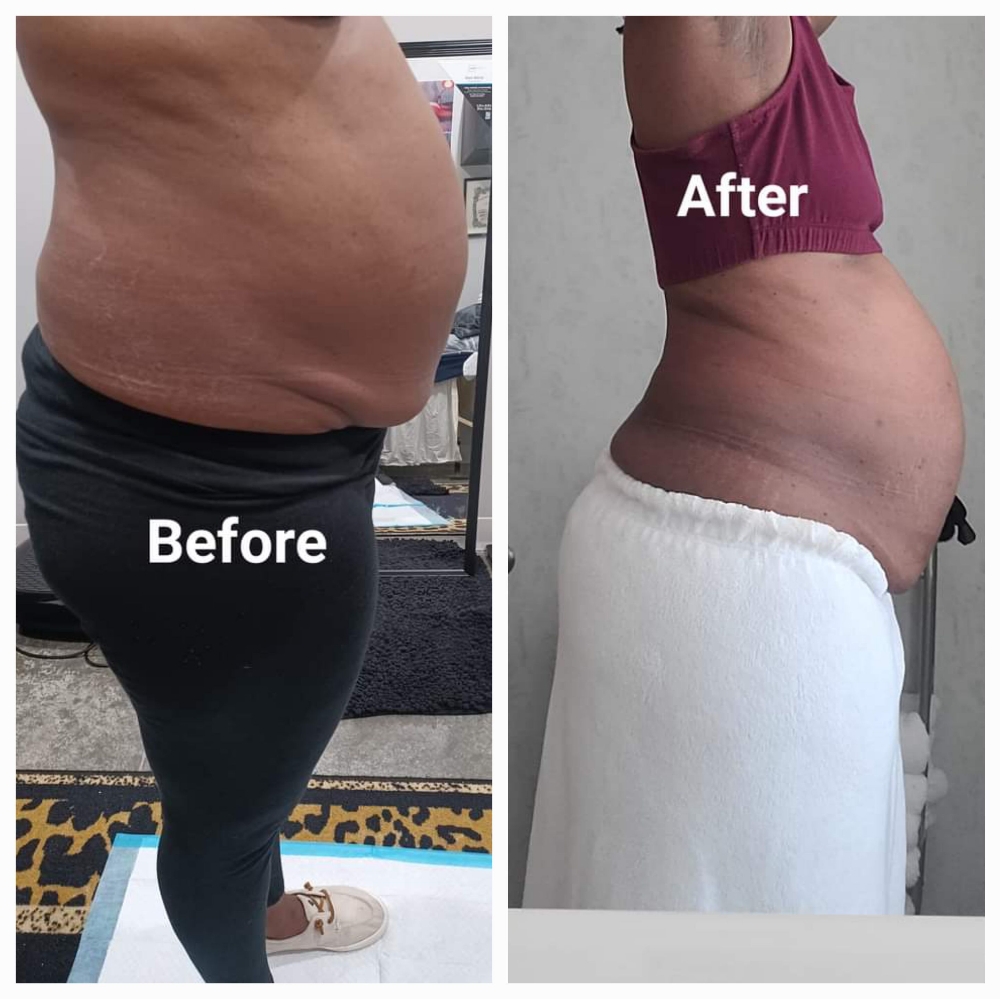 BODY WRAP 24 HOURS With Cavitation