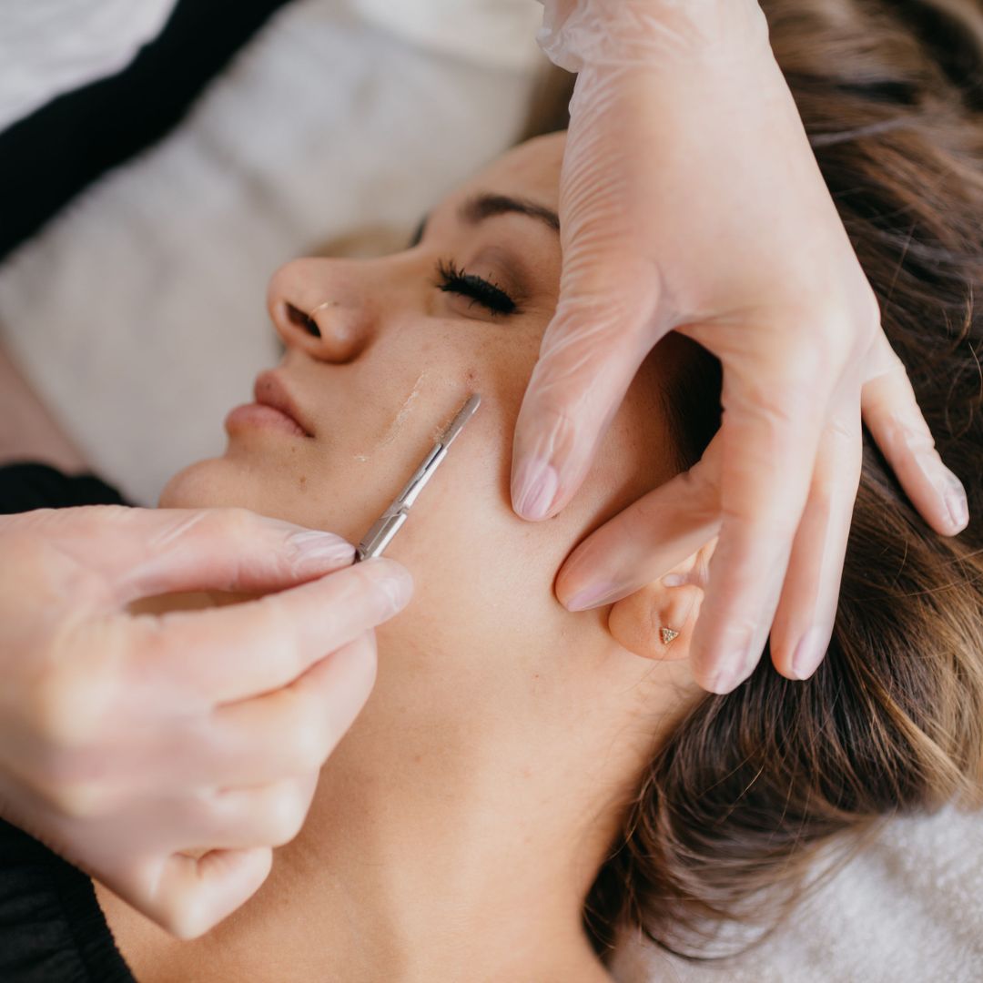 Dermaplane Treatment