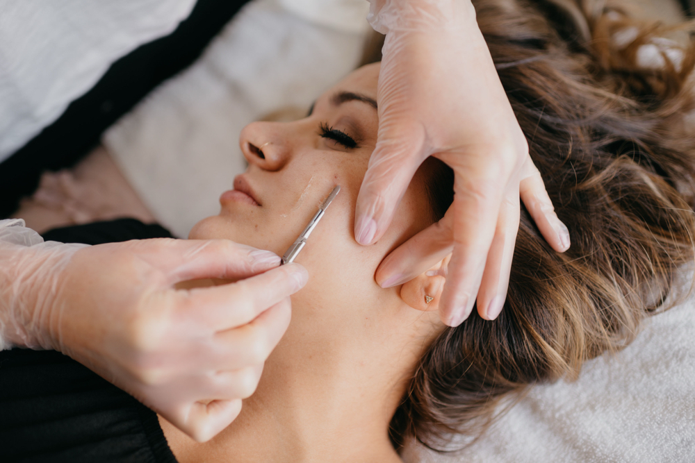 Dermaplane Treatment