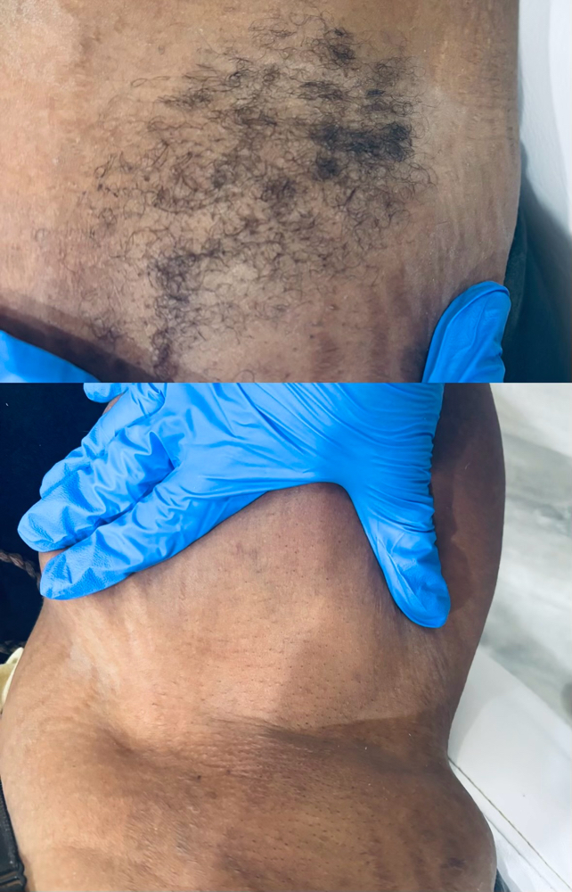 Armpit Waxing
