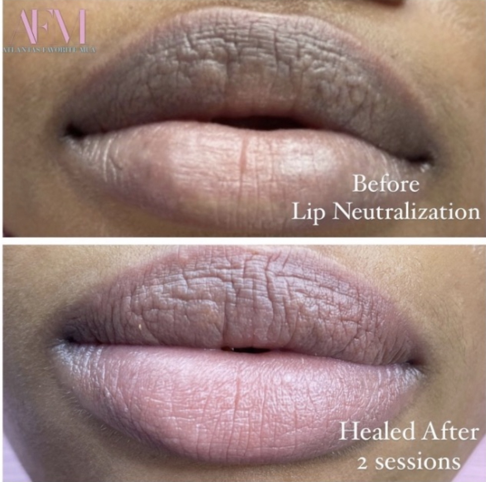 Lip Neutralization