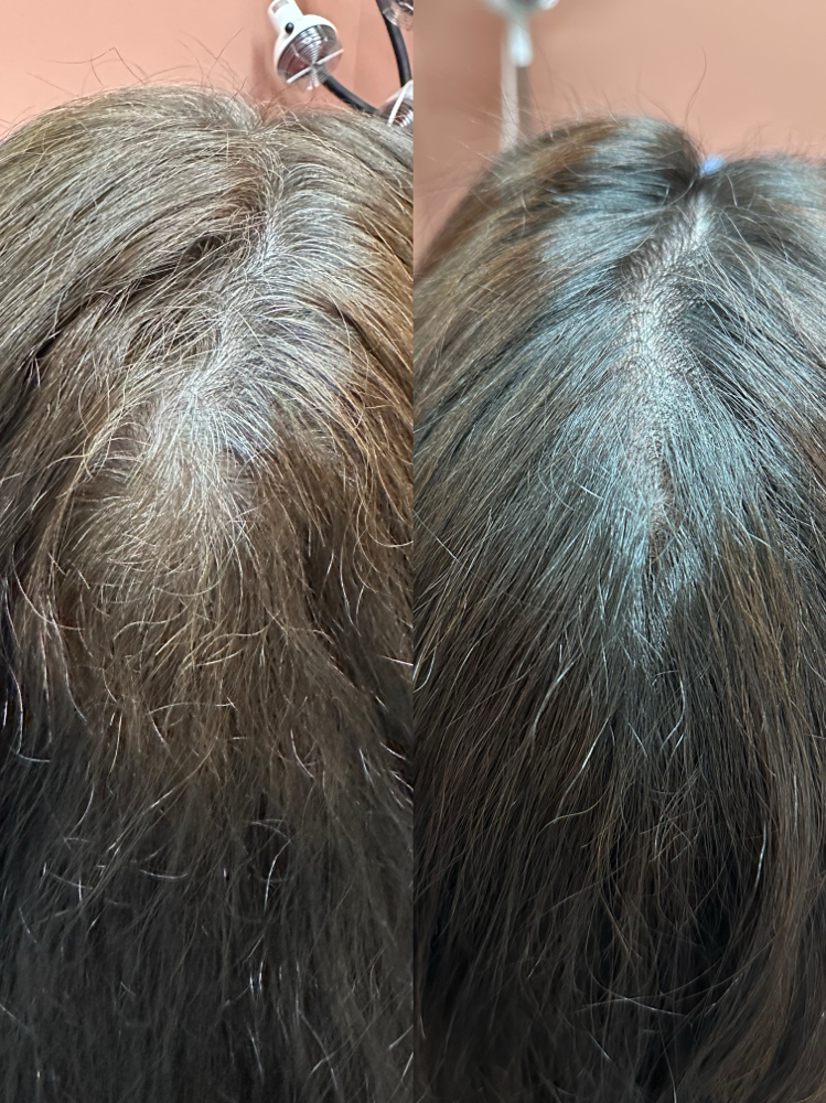 Root Touch Up