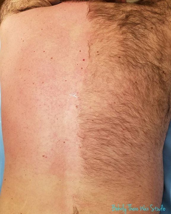 Full Back Wax