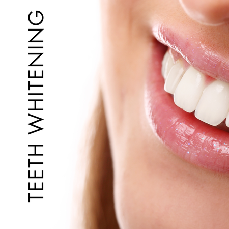 Teeth Whitening