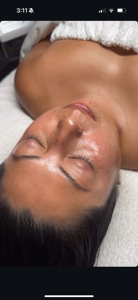 Express Facial