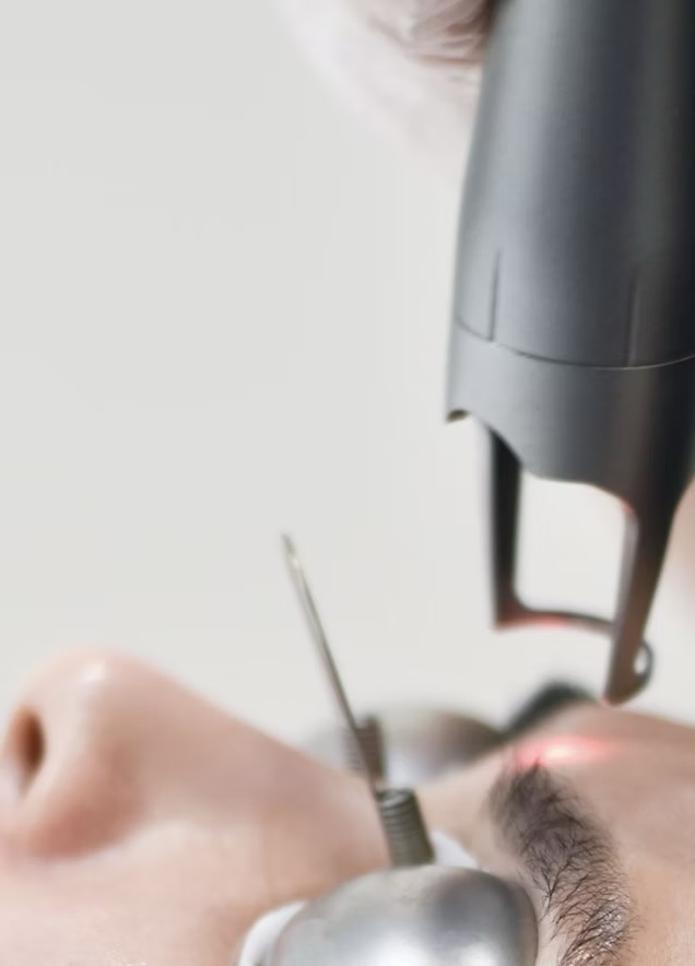 Laser - Brows