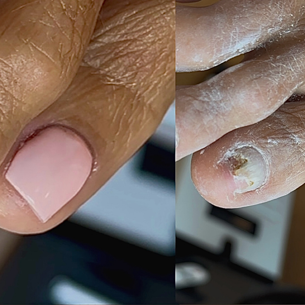 Deep Clean w/ Nail Restoration at Jubilee Nails in San Antonio, TX