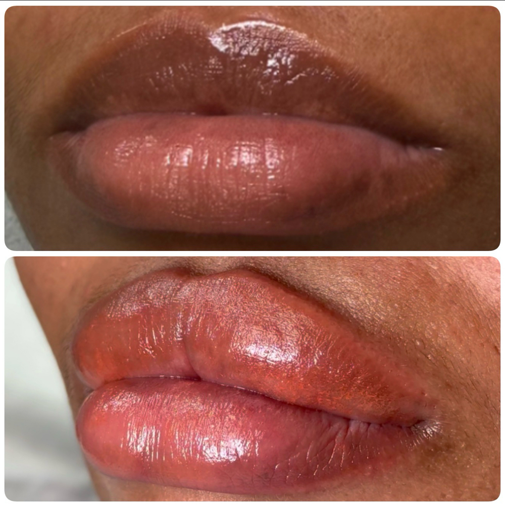 Lip Neutralization at The Gleaux Lab/Charmed Beauty, LLC in West Monroe, LA
